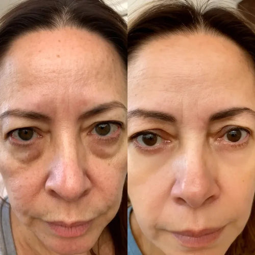 Crema Antiojeras + Masajeador de Luz Roja
