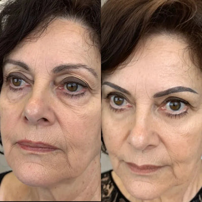 Crema Antiojeras + Masajeador de Luz Roja