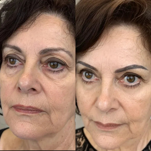 Crema Antiojeras + Masajeador de Luz Roja