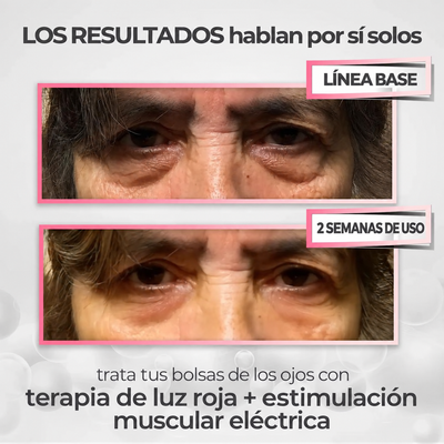 Crema Antiojeras + Masajeador de Luz Roja