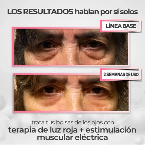 Crema Antiojeras + Masajeador de Luz Roja